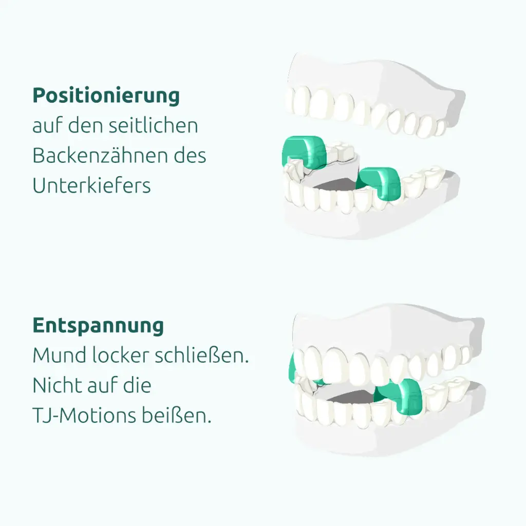 TJ-Motion® SOFT