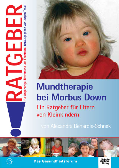 Mundtherapie bei Morbus Down E-Book