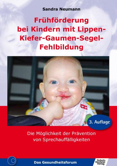 LKGS Lippen-Kiefer-Gaumen-Segel-Fehlbildung E-Book